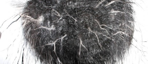 רויטל לסיק / הפרעת קצב